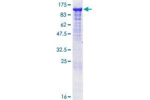 MALT1 Protein (AA 1-813) (GST tag)