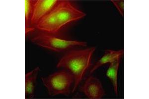 Immunofluorescence of human HeLa cells stained with Phalloidin-TRITC (Red) for Actin staining and UBE2S monoclonal antibody, clone AT2C12  (1 : 500) with Alexa 488 (Green). (UBE2S Antikörper  (AA 1-222))