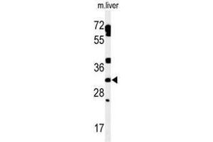 Western Blotting (WB) image for anti-TBC1 Domain Family, Member 7 (TBC1D7) (AA 157-187), (Middle Region) antibody (ABIN955099)