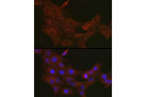Immunofluorescence analysis of PC-12 cells using TR antibody (ABIN3023477, ABIN3023478, ABIN3023479 and ABIN6220053) at dilution of 1:50. (TRAF7 Antikörper)