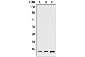 Western blot analysis of Spasmolysin expression in HEK293T (A), Raw264. (Trefoil Factor 2 Antikörper  (Center))