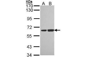 WB Image Sample (30 ug of whole cell lysate) A: H1299 B: Hela 7. (SNX18 Antikörper  (C-Term))