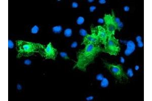 Anti-SCHIP1 mouse monoclonal antibody (ABIN2455665) immunofluorescent staining of COS7 cells transiently transfected by pCMV6-ENTRY SCHIP1 (RC206269). (SCHIP1 Antikörper)