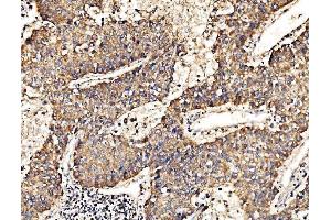 IHC analysis of HIP1R using anti-HIP1R antibody (ABIN7601290).