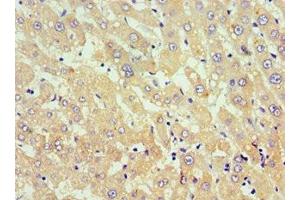 Immunohistochemistry (IHC) image for anti-Tumor Necrosis Factor (Ligand) Superfamily, Member 18 (TNFSF18) (AA 72-199) antibody (ABIN7173812)