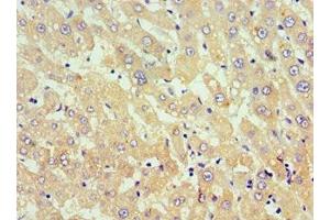 Immunohistochemistry of paraffin-embedded human liver tissue using ABIN7173812 at dilution of 1:100 (TNFSF18 Antikörper  (AA 72-199))