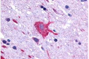 Immunohistochemical (Formalin/PFA-fixed paraffin-embedded sections) staining in human brain, neurons and glia with LGR4 polyclonal antibody . (LGR4 Antikörper  (C-Term))