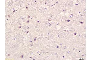 Formalin-fixed and paraffin embedded mouse brain labeled with Anti-PLAUR Polyclonal Antibody, Unconjugated  at 1:200 followed by conjugation to the secondary antibody and DAB staining.