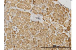 Immunoperoxidase of monoclonal antibody to PDK2 on formalin-fixed paraffin-embedded human pancreas. (PDK2 Antikörper  (AA 187-276))