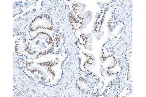Immunohistochemistry (IHC) image for anti-BMI1 Polycomb Ring Finger Oncogene (BMI1) (AA 250-300) antibody (ABIN7455106) (Rekombinanter BMI1 Antikörper  (AA 250-300))