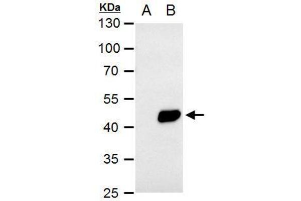 PDK1 Antikörper