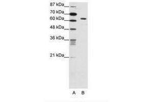 Image no. 1 for anti-SMAD, Mothers Against DPP Homolog 1 (SMAD1) (C-Term) antibody (ABIN202590)