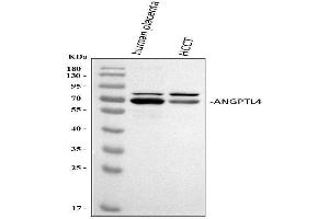 Western blot analysis of ANGPTL4 using anti-ANGPTL4 antibody (ABIN5518734).