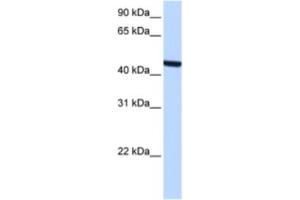 Western Blotting (WB) image for anti-Zinc Finger, C3HC-Type Containing 3 (ZCCHC3) antibody (ABIN2463365) (ZCCHC3 Antikörper)