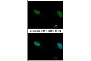 ICC/IF Image Immunofluorescence analysis of paraformaldehyde-fixed HeLa, using PB1, antibody at 1:500 dilution. (Polybromo 1 Antikörper  (N-Term))