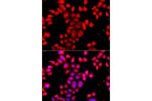 Immunofluorescence analysis of A549 cell using OSGEPL1 antibody. (OSGEPL1 Antikörper)
