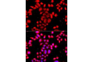Immunofluorescence analysis of A549 cell using OSGEPL1 antibody.