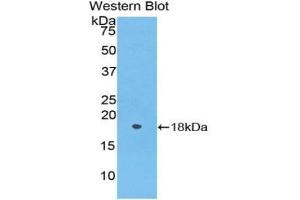 Western blot analysis of the recombinant protein. (Periostin Antikörper  (AA 24-173))