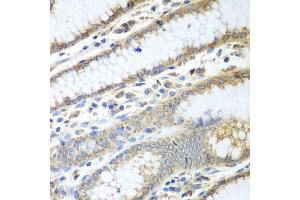 Immunohistochemistry of paraffin-embedded human stomach using PDIA3 antibody. (PDIA3 Antikörper  (AA 206-505))