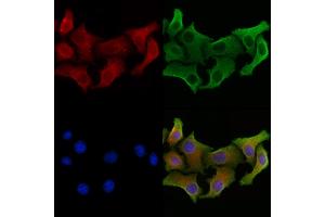 ABIN7094567 and ABIN7098616 staining Hela cells by IF/ICC.