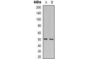 Western blot analysis of FOXN4 expression in Jurkat (A), HepG2 (B) whole cell lysates. (FOXN4 Antikörper  (C-Term))