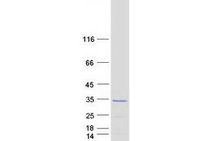 Western Blotting (WB) image for Muscle RAS Oncogene Homolog (MRAS) (Transcript Variant 1) protein (Myc-DYKDDDDK Tag) (ABIN2726314)