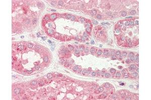Human Kidney: Formalin-Fixed, Paraffin-Embedded (FFPE) (Stim2 Antikörper  (N-Term))