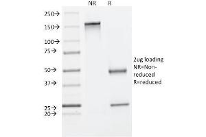 SDS-PAGE Analysis Purified Cytokeratin 8 Mouse Monoclonal Antibody (C-43). (KRT8 Antikörper)