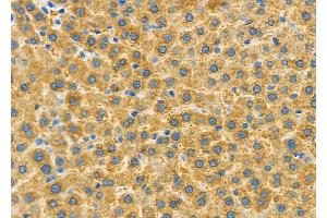 ABIN6262577 and ABIN6279542 at 1/100 staining Rat liver tissue by IHC-P. (IMMP2L Antikörper  (Internal Region))