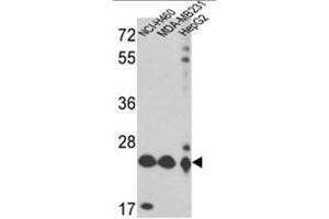 Western blot analysis of PRDX3 Antibody (Peroxiredoxin 3 Antikörper  (N-Term))