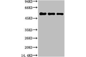 Western blot analysis of 1) Hela, 2) Mouse Brain Tissue, 3) Rat Brain Tissue, diluted at 1:5000. (TUBB1 Antikörper)