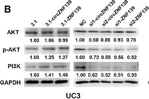 ZNF139 and its circRNA (circZNF139) activates PI3K/AKT signaling pathway in BC cells. (GAPDH Antikörper)