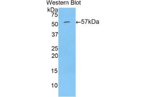 Western blot analysis of the recombinant protein. (N-Acetyl alpha-D-Glucosaminidase (AA 449-709) Antikörper)