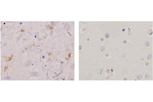 Immunohistochemistry analysis of human brain tissue slide (Paraffin embedded) using Rabbit Anti-Glutamine Synthetase Polyclonal Antibody (Left, ABIN398821) and Purified Rabbit IgG (Whole molecule) Control (Right, ABIN398653) (GLN1 Antikörper  (AA 300-350))