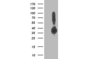 Western Blotting (WB) image for anti-Aldolase B, Fructose-Bisphosphate (ALDOB) antibody (ABIN1496608) (ALDOB Antikörper)