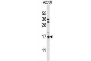 Western Blotting (WB) image for anti-Parathymosin (PTMS) antibody (ABIN3004110)