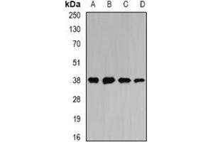 Western blot analysis of MATH-1 expression in SW620 (A), HepG2 (B), mouse liver (C), mouse heart (D) whole cell lysates. (ATOH1 Antikörper)