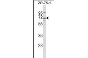 C10orf2 Antibody (C-term) (ABIN656726 and ABIN2845951) western blot analysis in ZR-75-1 cell line lysates (35 μg/lane). (C10orf2 Antikörper  (C-Term))
