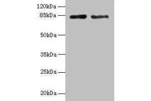 Western blot All lanes: HJURP antibody at 12 μg/mL Lane 1: Jurkat whole cell lysate Lane 2: Hela whole cell lysate Secondary Goat polyclonal to rabbit IgG at 1/10000 dilution Predicted band size: 84, 78, 75 kDa Observed band size: 84 kDa (HJURP Antikörper  (AA 1-748))