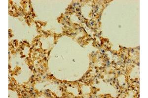 Immunohistochemistry of paraffin-embedded human lung tissue using ABIN7170255 at dilution of 1:100 (SLC43A3 Antikörper  (AA 209-278))