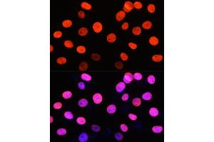 Immunofluorescence analysis of NIH-3T3 cells using Symmetric DiMethyl-Histone H3-R2 Rabbit pAb (ABIN3016053, ABIN3016054, ABIN3016055, ABIN1680220 and ABIN6219534) at dilution of 1:100 (40x lens).