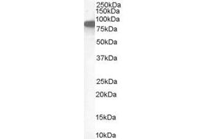 ABIN185664 (1µg/ml) staining of Human Placenta lysate (35µg protein in RIPA buffer). (Ezrin Antikörper  (Internal Region))
