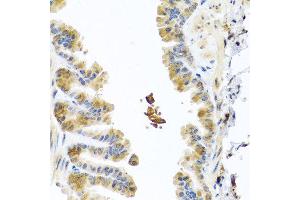 Immunohistochemistry of paraffin-embedded mouse lung using CHI3L2 antibody at dilution of 1:100 (40x lens).