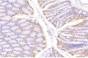 Immunohistochemistry analysis of paraffin-embedded mouse colon using,NT5C1B (ABIN7072861) at dilution of 1: 1200 (NT5C1B Antikörper)