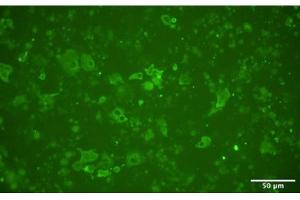 Immunofluorescence staining of Vero E6 cells 5 days after inoculation with sample 49 that tested negative by Ag-RDT.