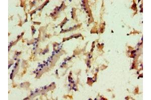 Immunohistochemistry of paraffin-embedded human prostate tissue using ABIN7157655 at dilution of 1:100 (KIF6 Antikörper  (AA 565-814))