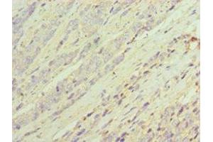 Immunohistochemistry (IHC) image for anti-Aldo-Keto Reductase Family 1, Member C3 (3-alpha Hydroxysteroid Dehydrogenase, Type II) (AKR1C3) (AA 1-323) antibody (ABIN7143694)