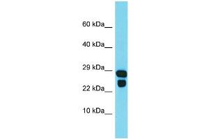 Western Blotting (WB) image for anti-IdnK Gluconokinase Homolog (IDNK) (Middle Region) antibody (ABIN2790936)