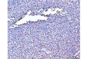IHC analysis of Filamin B/FLNB using anti-Filamin B/FLNB antibody (ABIN7601606).