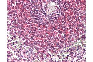 Immunohistochemistry (IHC) image for anti-Nuclear Factor of kappa Light Polypeptide Gene Enhancer in B-Cells 1 (NFKB1) (N-Term) antibody (ABIN1103248)